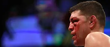r-ufc-nick-diaz-bloody.jpg